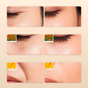 Strumento di bellezza al collagene con 2 modalità d'uso e 3 intensità.