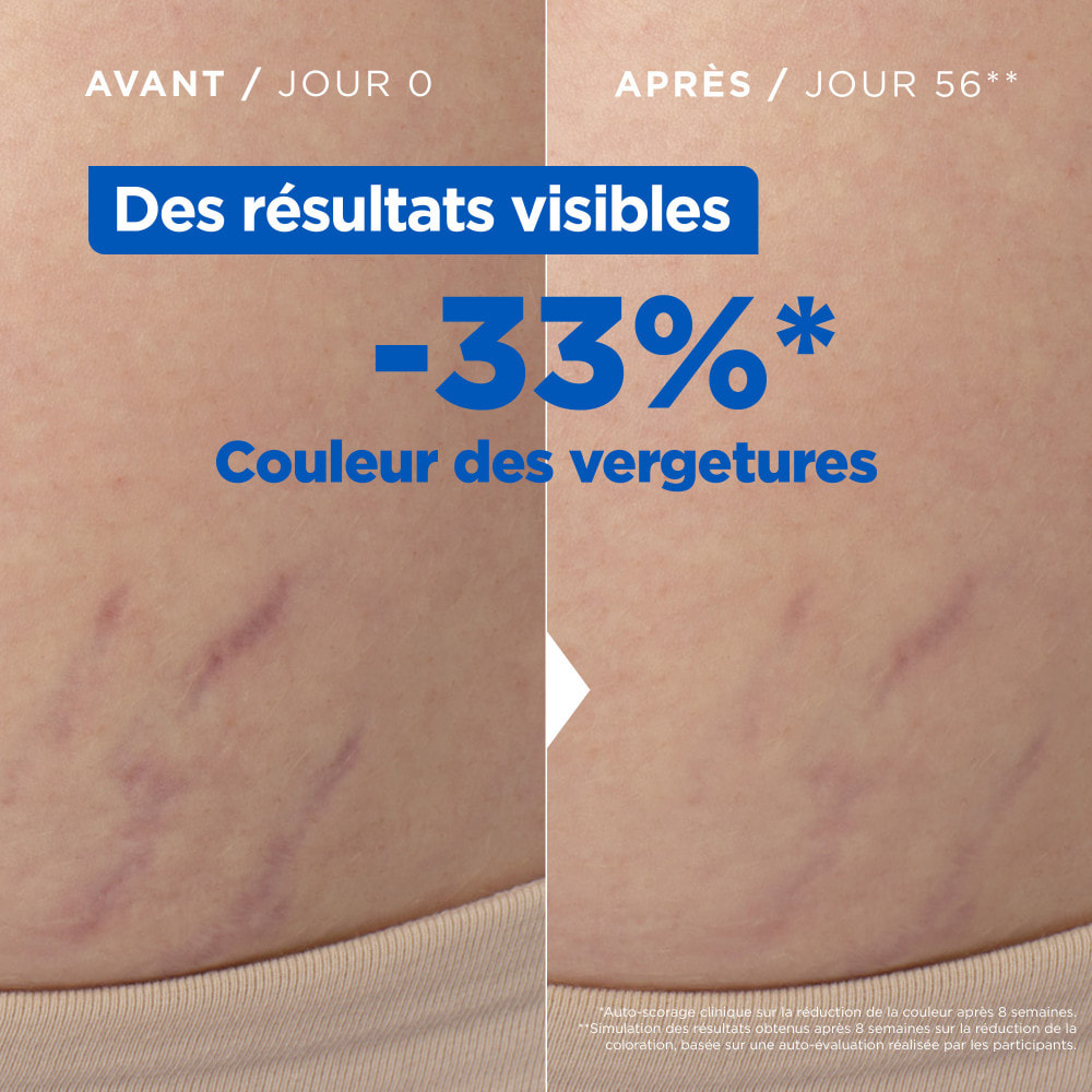 Mixa Huile Anti-Vergetures 100ML