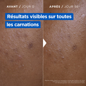 Mixa Crème Niacinamide Correction Éclat 400ml