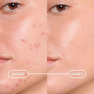 Sébium - Kérato+Cover Gel-Crème Teinté Anti-Imperfections Haute Tolérance 30 ml