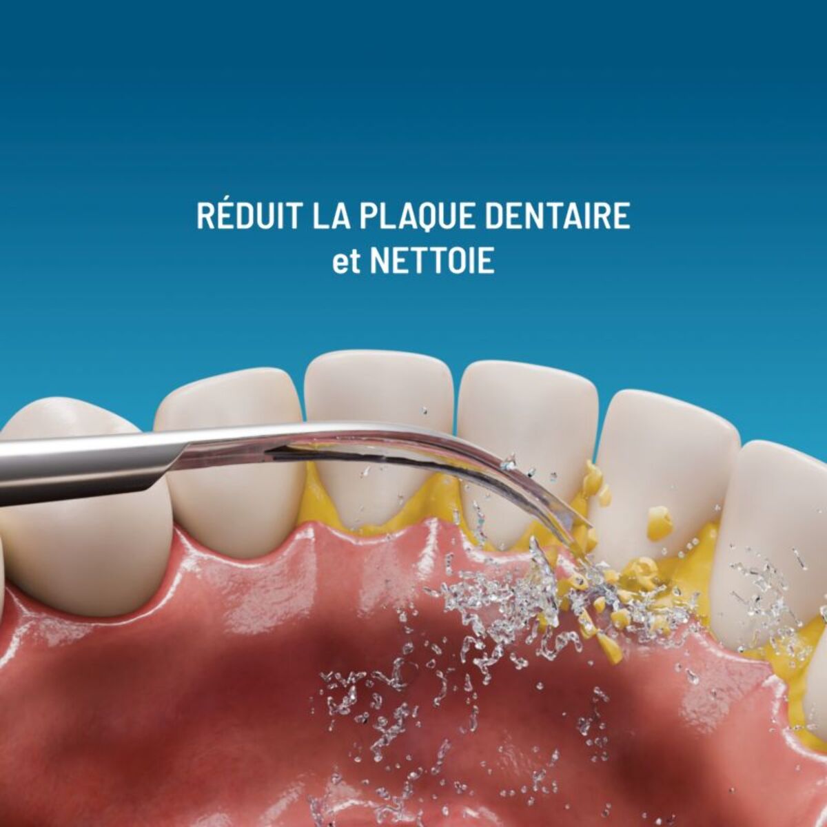 Tête HAEPI de détartrage pour brosse à dents Hi-Jul