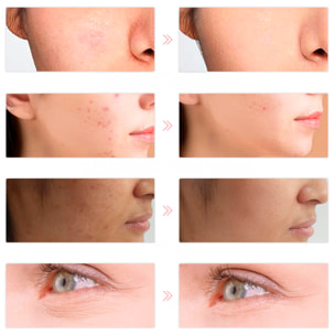 Máscara LED fotónica. Tratamiento de luz 7 colores. Cuidado facial, anti edad, rejuvenecimiento de la piel.