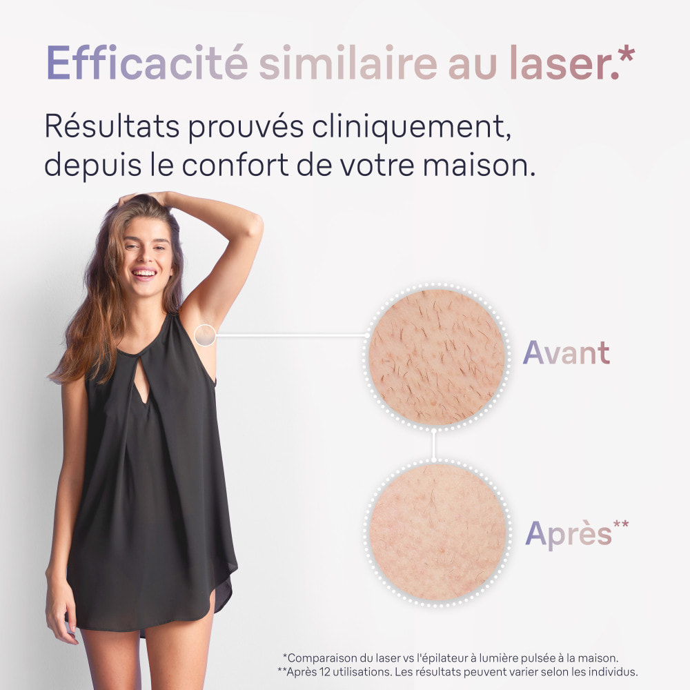 Braun IPL Skin i·expert (Épilateur A Lumière Pulsée) - Avec Pochette, Rasoir Venus et 2 Têtes