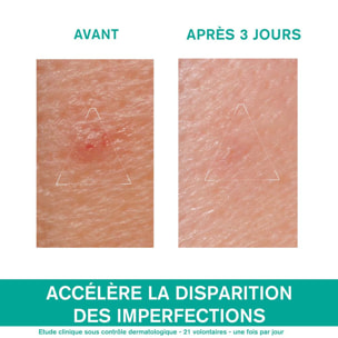 Hyséac - Pâte SOS 15 ml