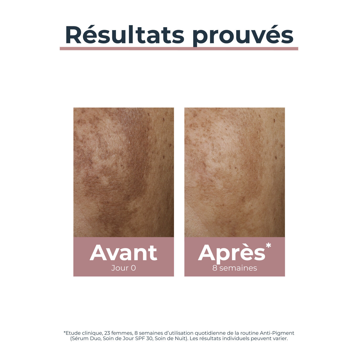 Anti-Pigment SPF30 - Crème de Jour Hydratante & Anti-Tâches - Tous Types de Peaux 50 ml