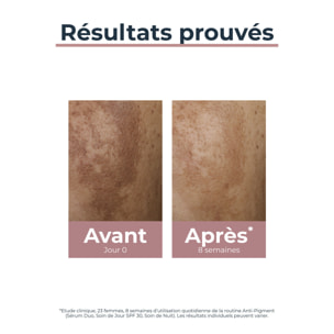 Anti-Pigment SPF30 - Crème de Jour Hydratante & Anti-Tâches - Tous Types de Peaux 50 ml