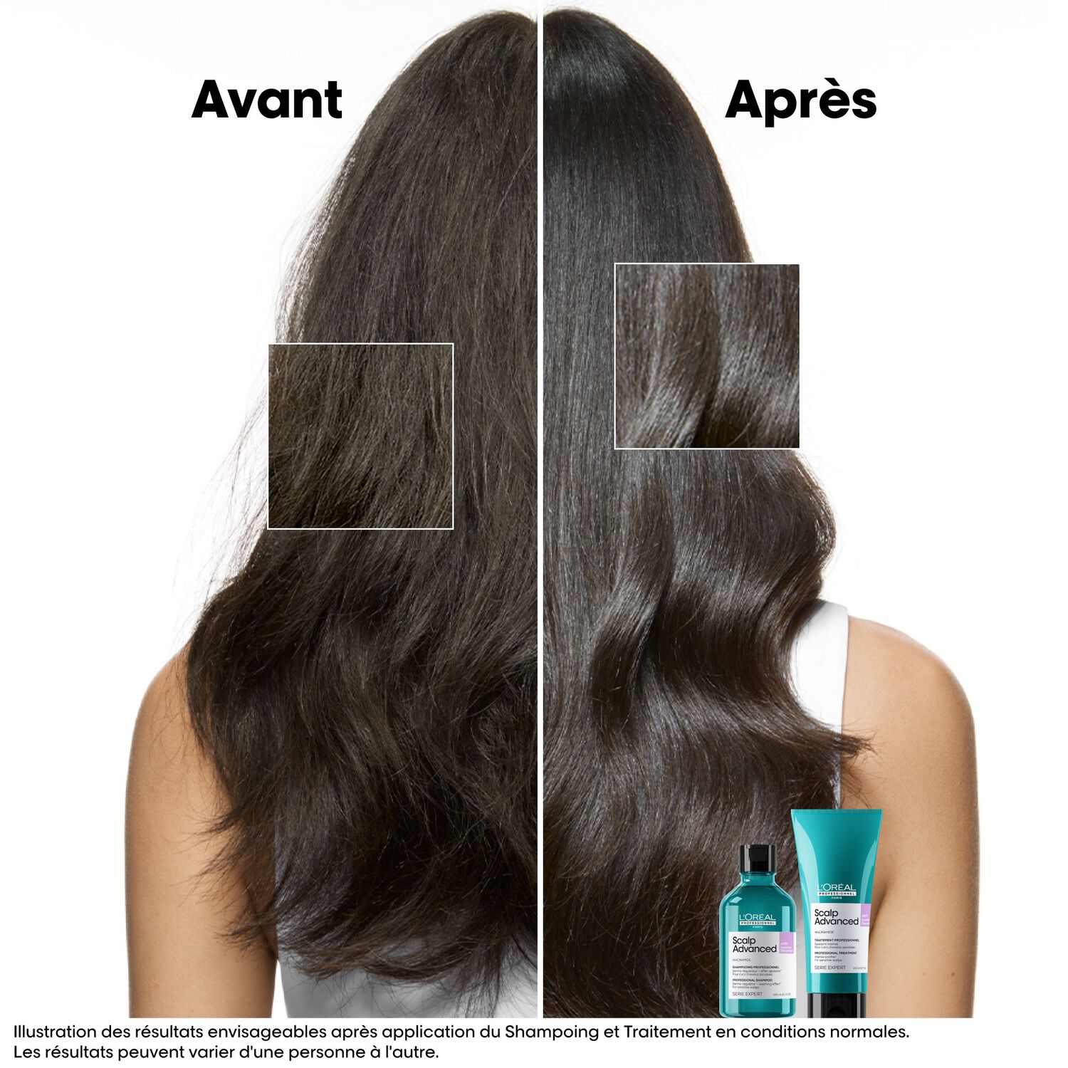 Série Expert Scalp Advanced Anti-Inconfort - Shampooing Dermo-Regulateur Effet Apaisant - Cuirs Chevelus Sensibles 300 ml