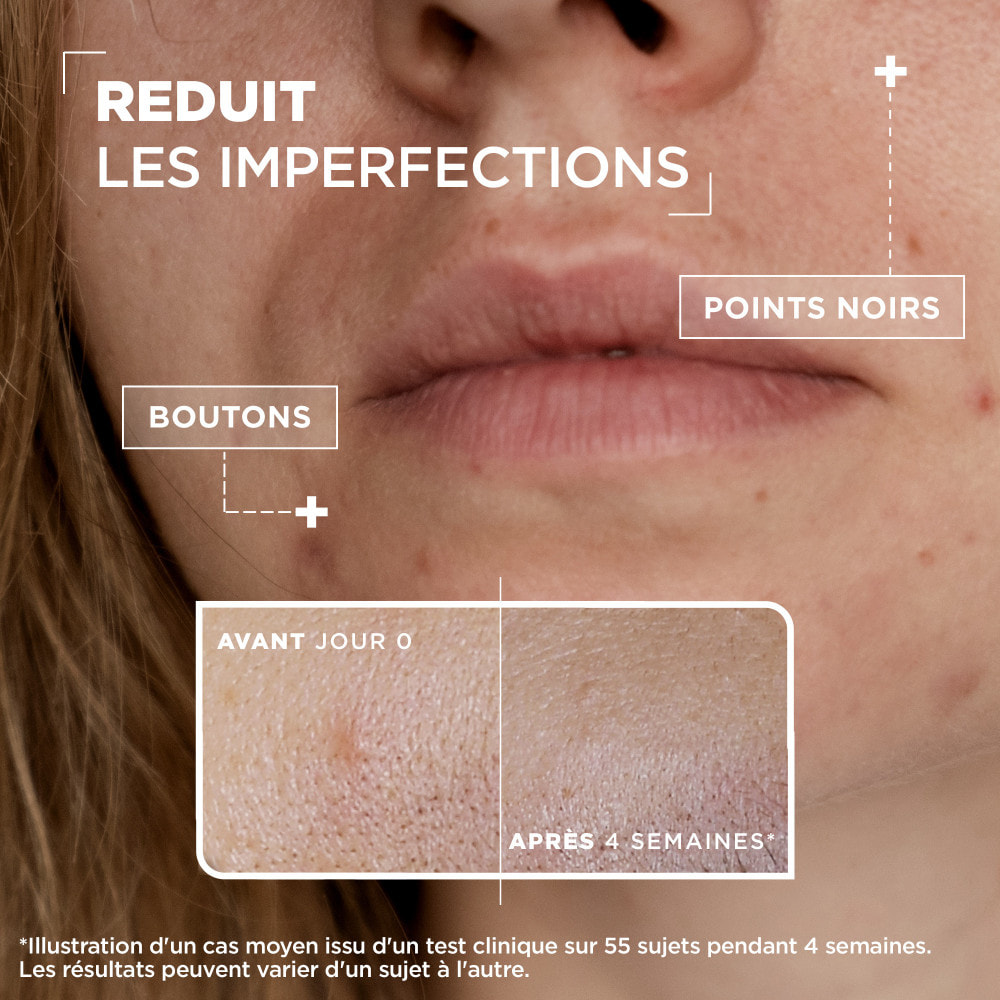 Mixa Lab Sérum Concentré Anti-imperfections à l'acide salycilique et niacinamide 30ml