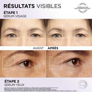L'Oréal Paris Revitalift Filler Sérum Yeux à l'Acide Hyaluronique et à la Caféine 20ml