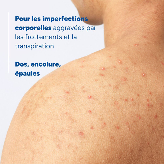 Keracnyl - Spray Corps Asséchant Anti-Boutons 150 ml