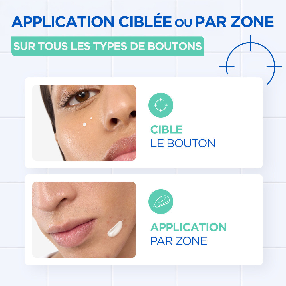 Mixa Pâte Concentrée Anti-Bouton, Pâte Anti-Boutons Ciblée à l'Acide Salicylique et à la Niacinamide- Action rapide sur tous les