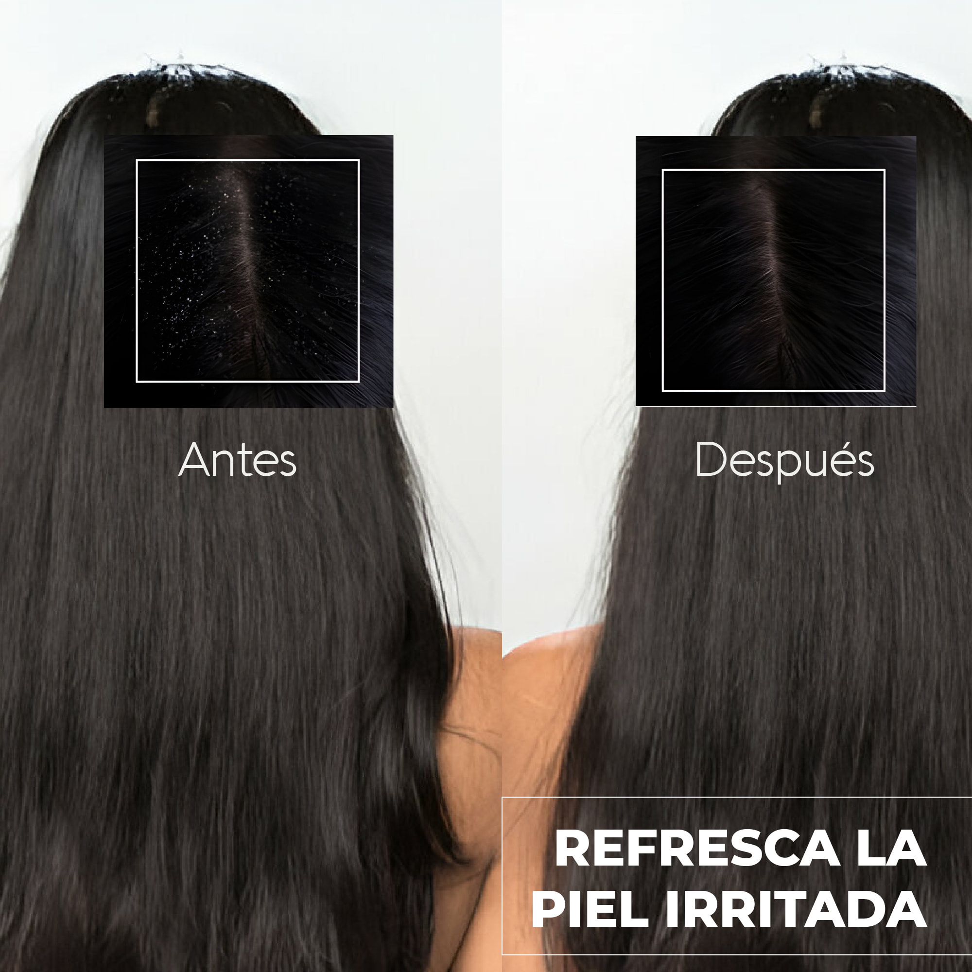 Champú Peeling - Cabello graso - 1 L