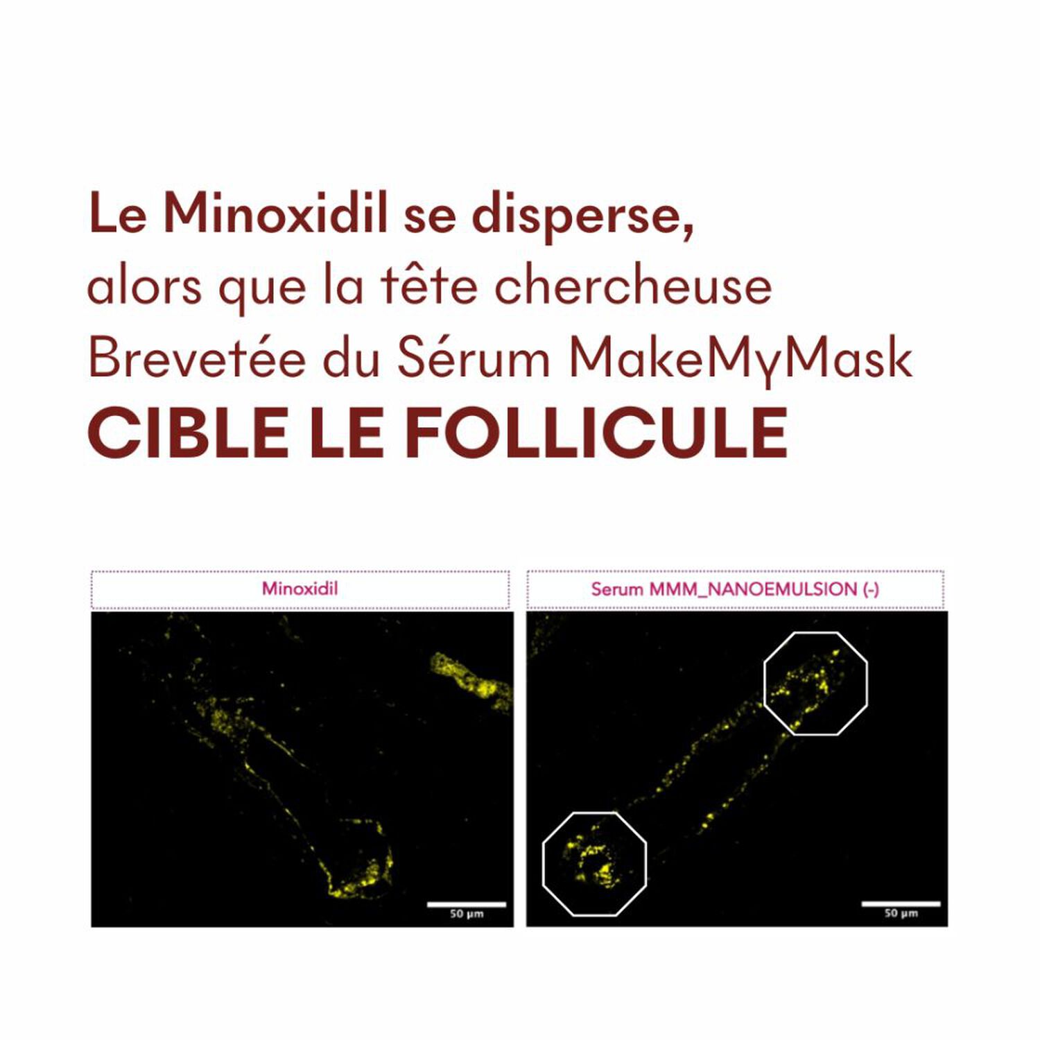 Tricho-Boost - Sérum Chute de Cheveux 20 ml