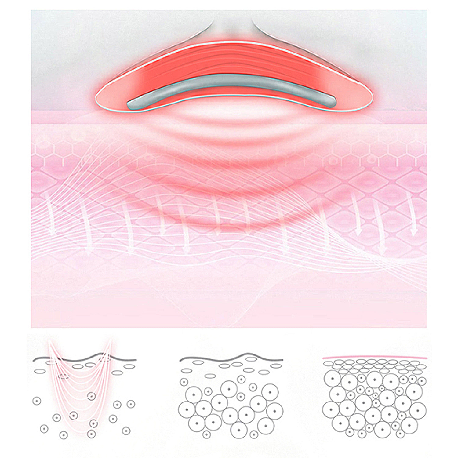 Herramienta de belleza fototerapia para el cuello.3 modos de luz ajustables.