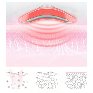 Herramienta de belleza fototerapia para el cuello.3 modos de luz ajustables.