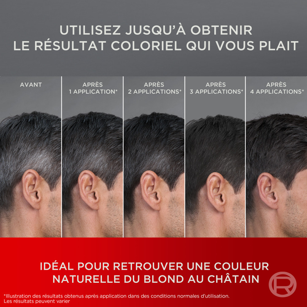 L'Oréal Paris Progress Homme Gel de repigmentation