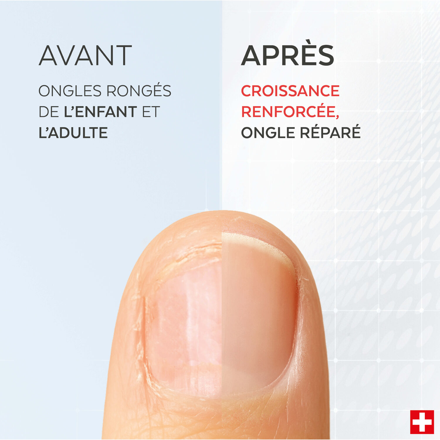 Professional  - Sérum Ongles Rongés 8ml