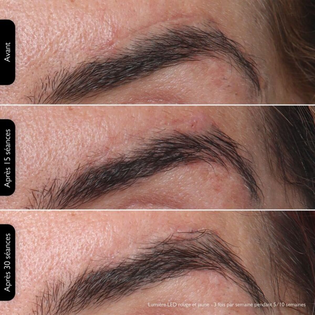 Masque LED SILK'N LED Face Mask 100 FLM100