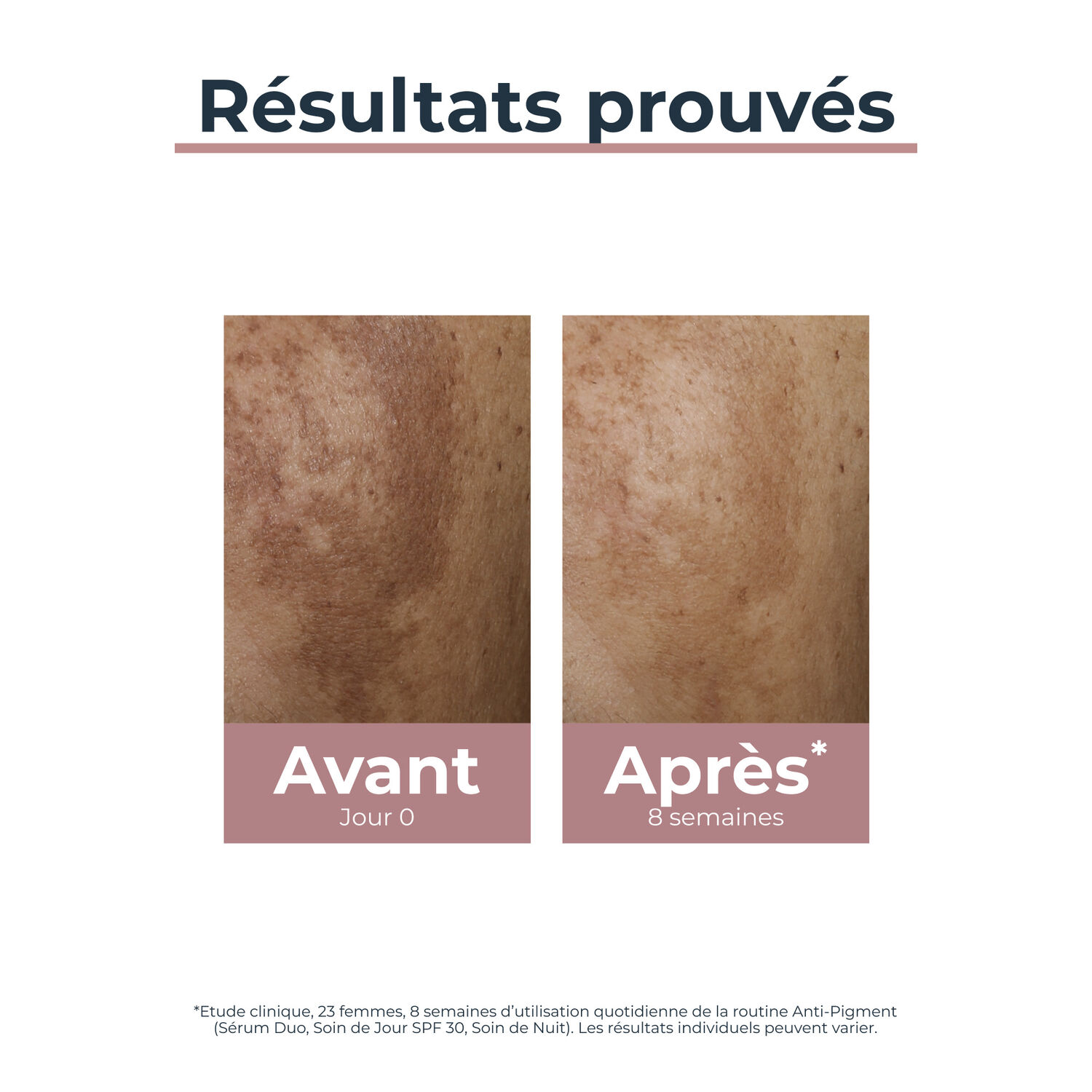 Anti-Pigment - Crème de Nuit Régénératrice Anti-Tâches - Tous Types de Peaux 50 ml