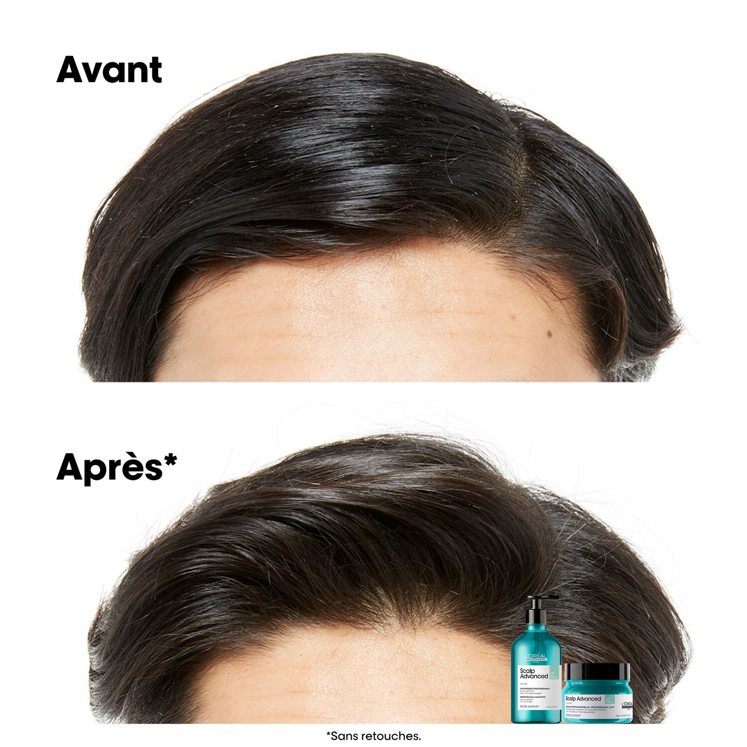Scalp Advanced - Shampooing Dermo-Purifiant - Cuirs Chevelus Gras 500 ml