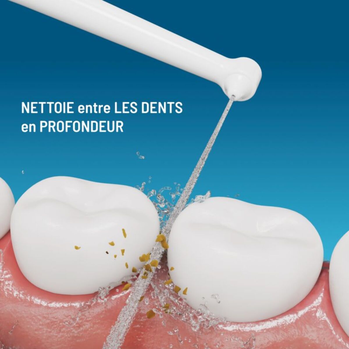 Canule HAEPI de jet d'eau pour brosse à dents