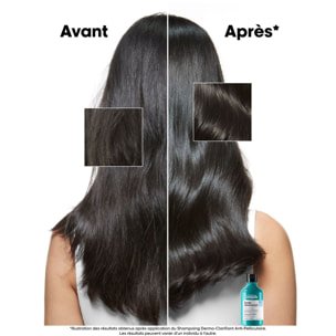 Scalp Advanced - Shampooing Dermo-Clarifiant - Cuirs Chevelus à Pellicules 300 ml