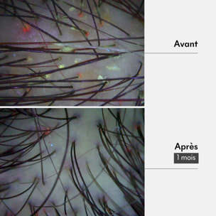 Boue Tricho-Detox - Pré-Shampoing Detox 180 ml