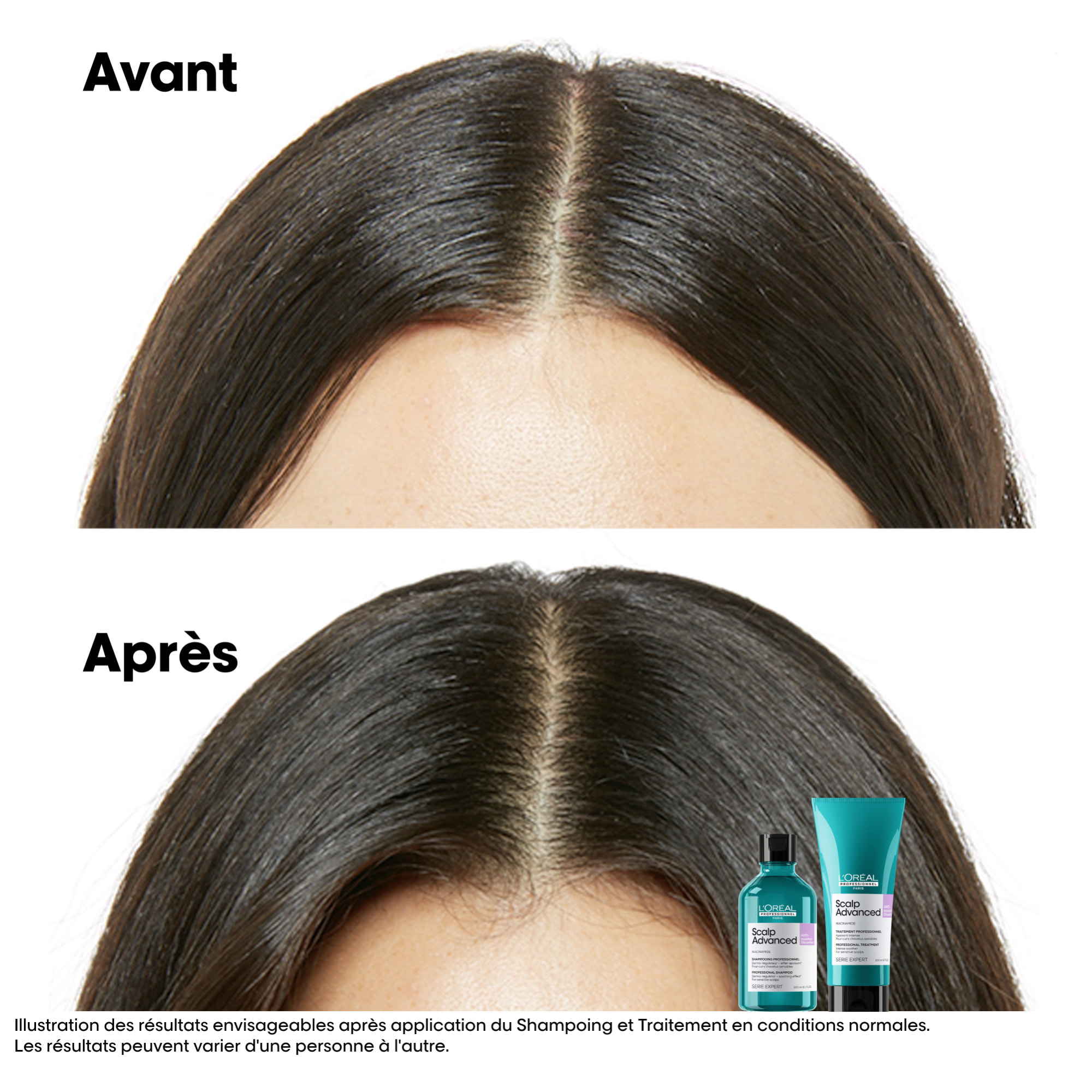 Série Expert Scalp Advanced Recharge Anti-Inconfort 500ml