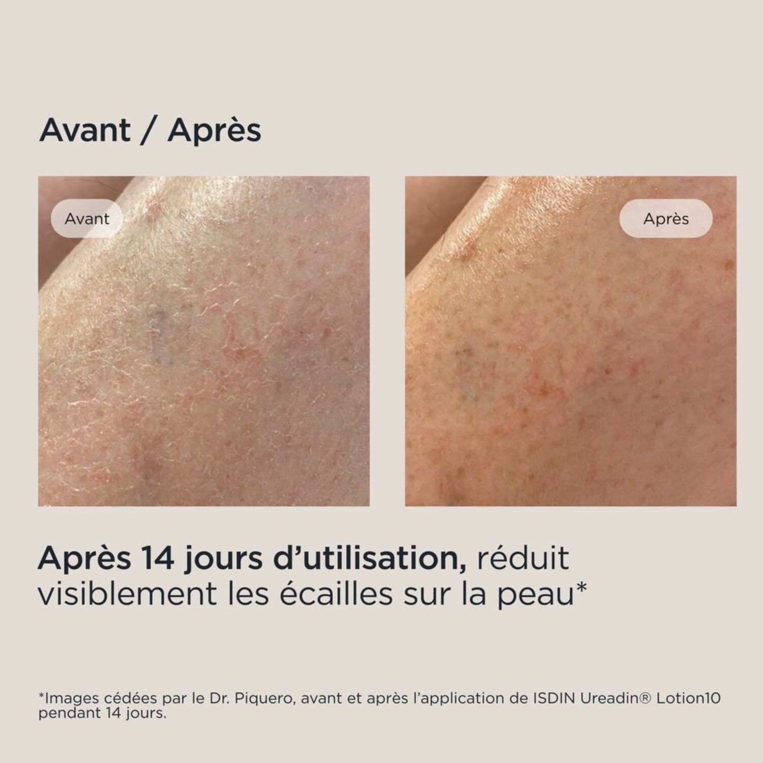 Ureadin Ultra 10 - Lotion Plus Repair Hydratante et Réparatrice 400 ml