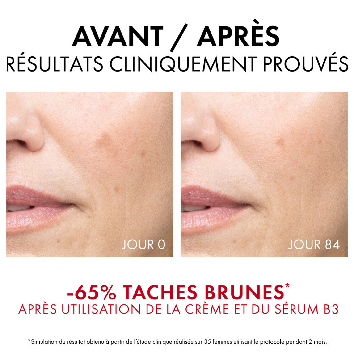 Liftactiv SPF50 - Crème de Jour B3 Anti-Taches Brunes 50 ml