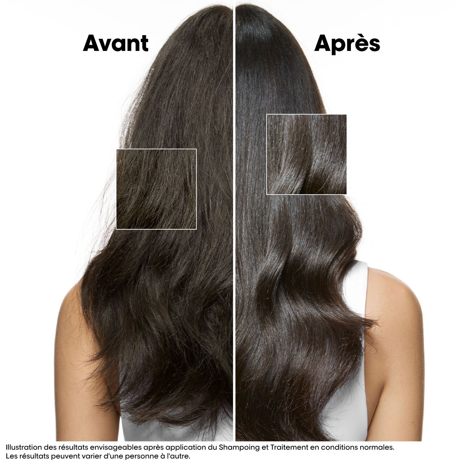 Scalp Advanced - Traitement Apaisant Intense Anti-Inconfort 200 ml