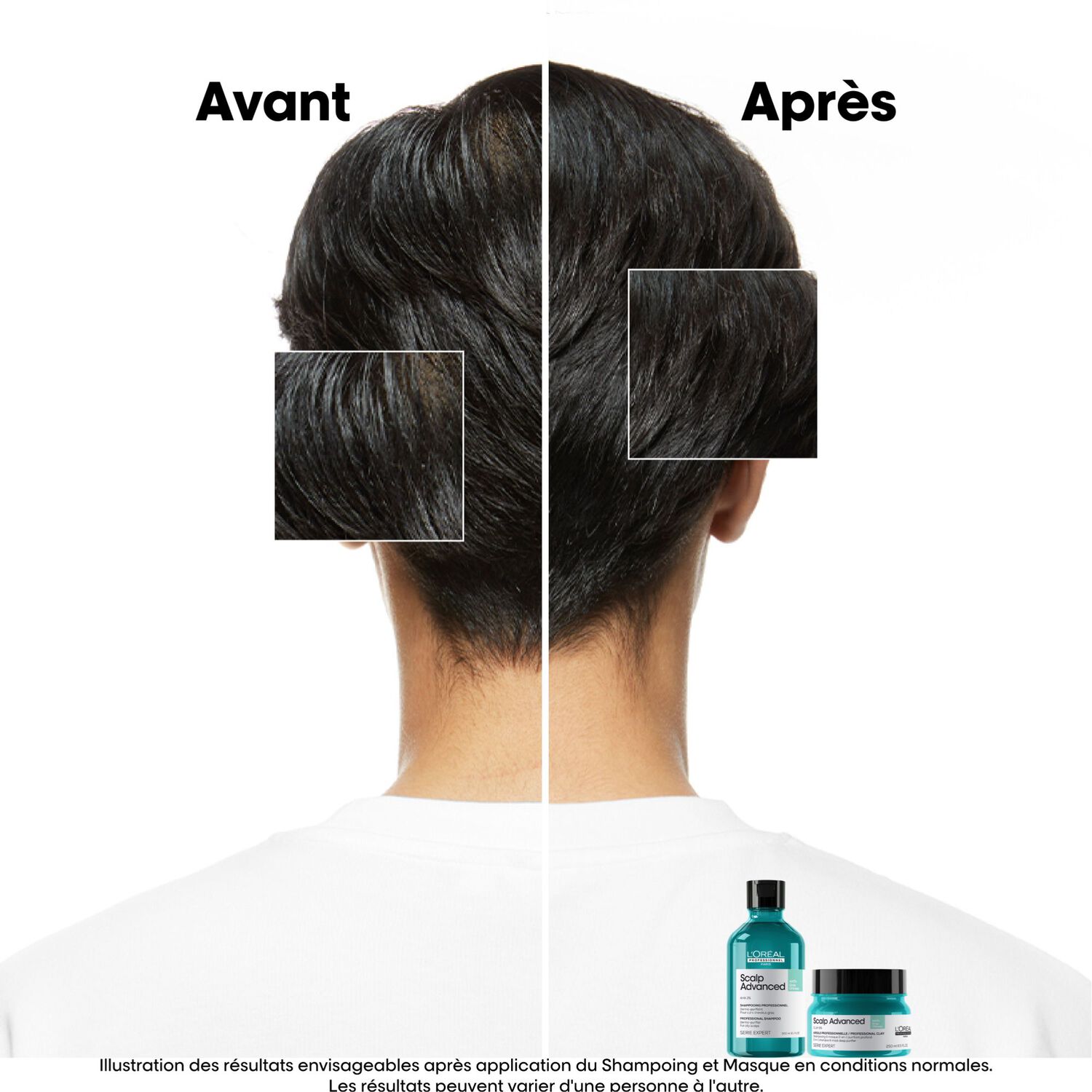 Scalp Advanced - Argile 2-en-1 Purifiante Anti-Gras 250 ml