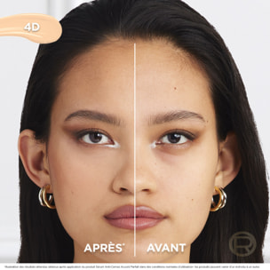 L'Oréal Paris Sérum Anti-Cernes Accord Parfait 4D 11ml