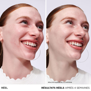 Bye Bye Redness - Sérum Anti-Rougeurs à l'Avoine Colloïdale 30 ml
