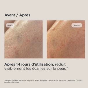 Ureadin Ultra 10 - Lotion Plus Repair Hydratante et Réparatrice 400 ml