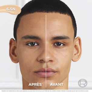 L'Oréal Paris Sérum Anti-Cernes Accord Parfait 6.5N 11ml