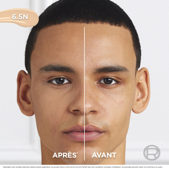 L'Oréal Paris Sérum Anti-Cernes Accord Parfait 6.5N 11ml