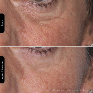 Masque LED SILK'N LED Face Mask 100 FLM100