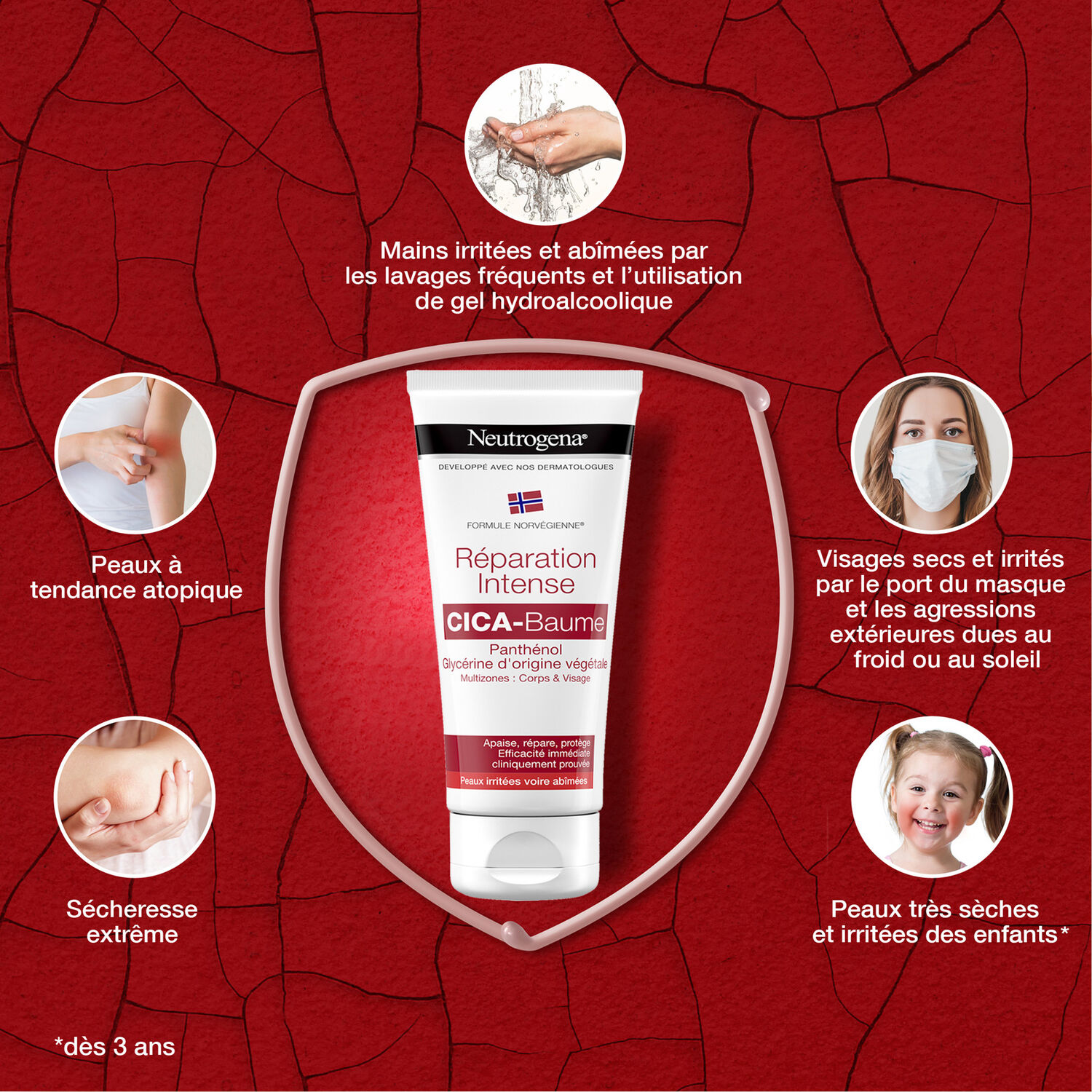 Réparation Intense - NEUTROGENA® CICA-Baume Multizones 100 ml