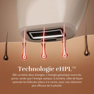Epilateur lumière pulsée SILK'N Infinity fast