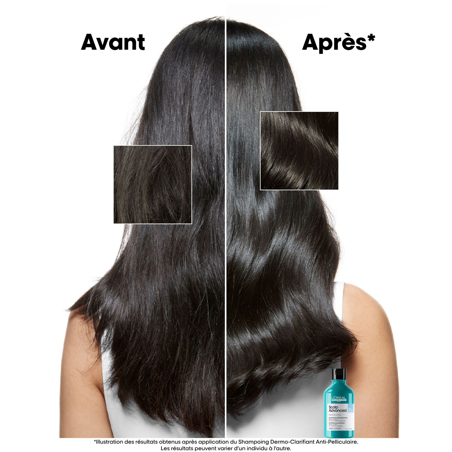 Serie Expert Scalp Advanced - Shampooing Dermo-Clarifiant - Cuirs Chevelus à Pellicules 500 ml