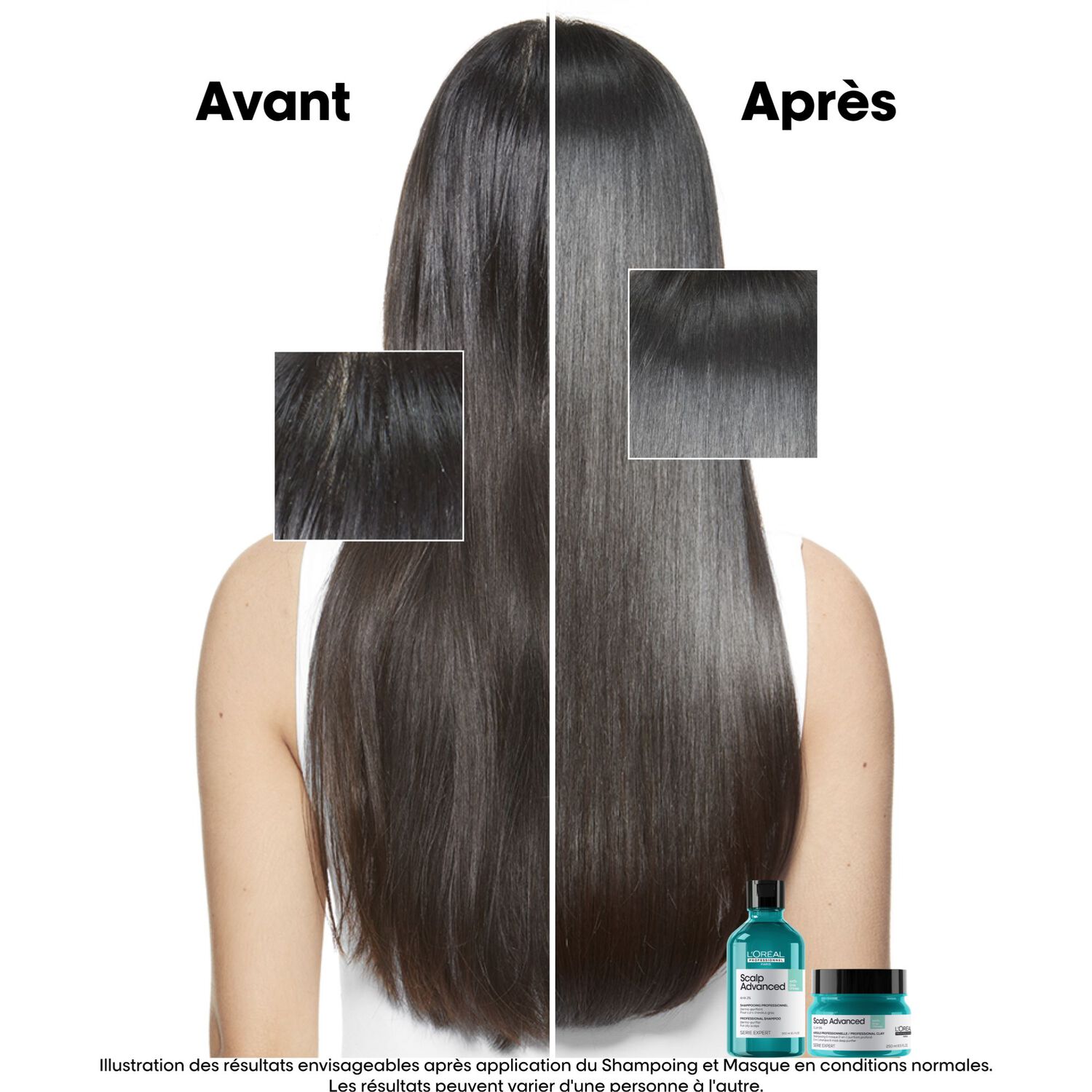 Scalp Advanced - Argile 2-en-1 Purifiante Anti-Gras 250 ml