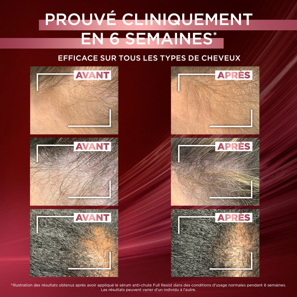 L'Oréal Paris Elseve Full Resist Cure 3 Sérums Anti-Chute de cheveux 3x102ml