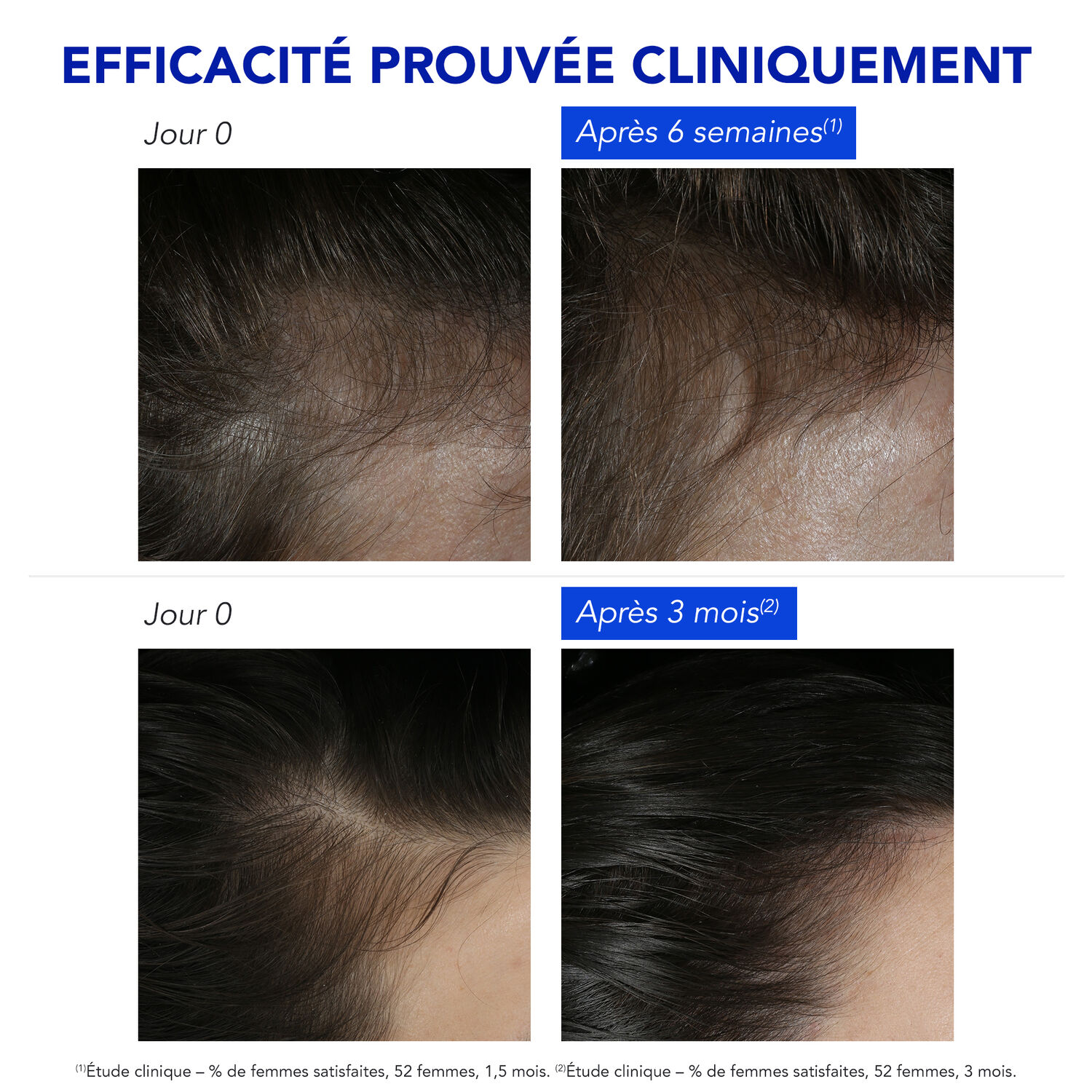 Phytophanere - Antichute Réactionnelle - 12 Ampoules x 5ml