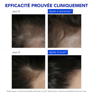 Phytophanere - Antichute Réactionnelle - 12 Ampoules x 5ml