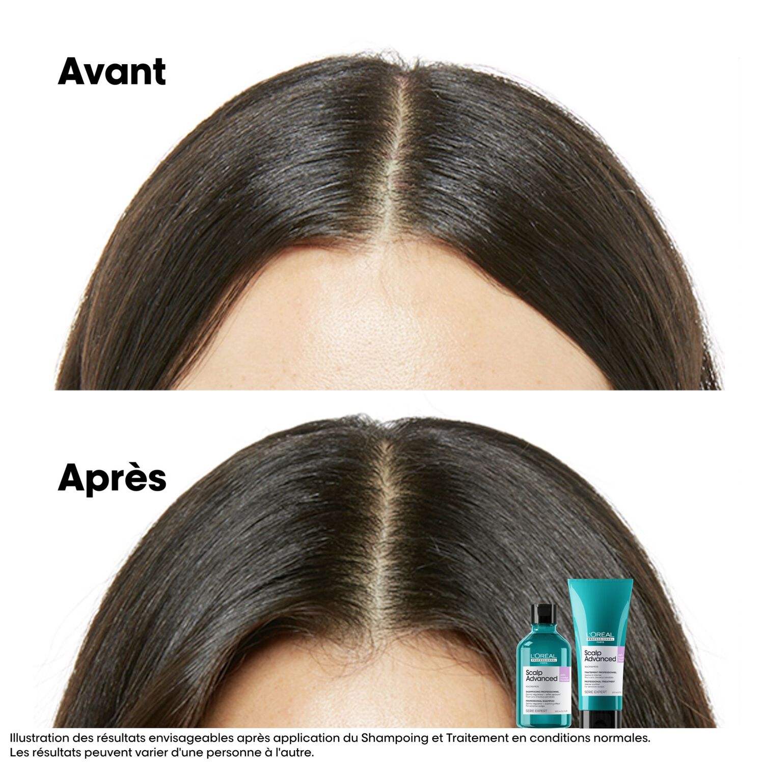 Scalp Advanced - Éco-Recharge Shampooing Dermo-Régulateur Anti-Inconfort