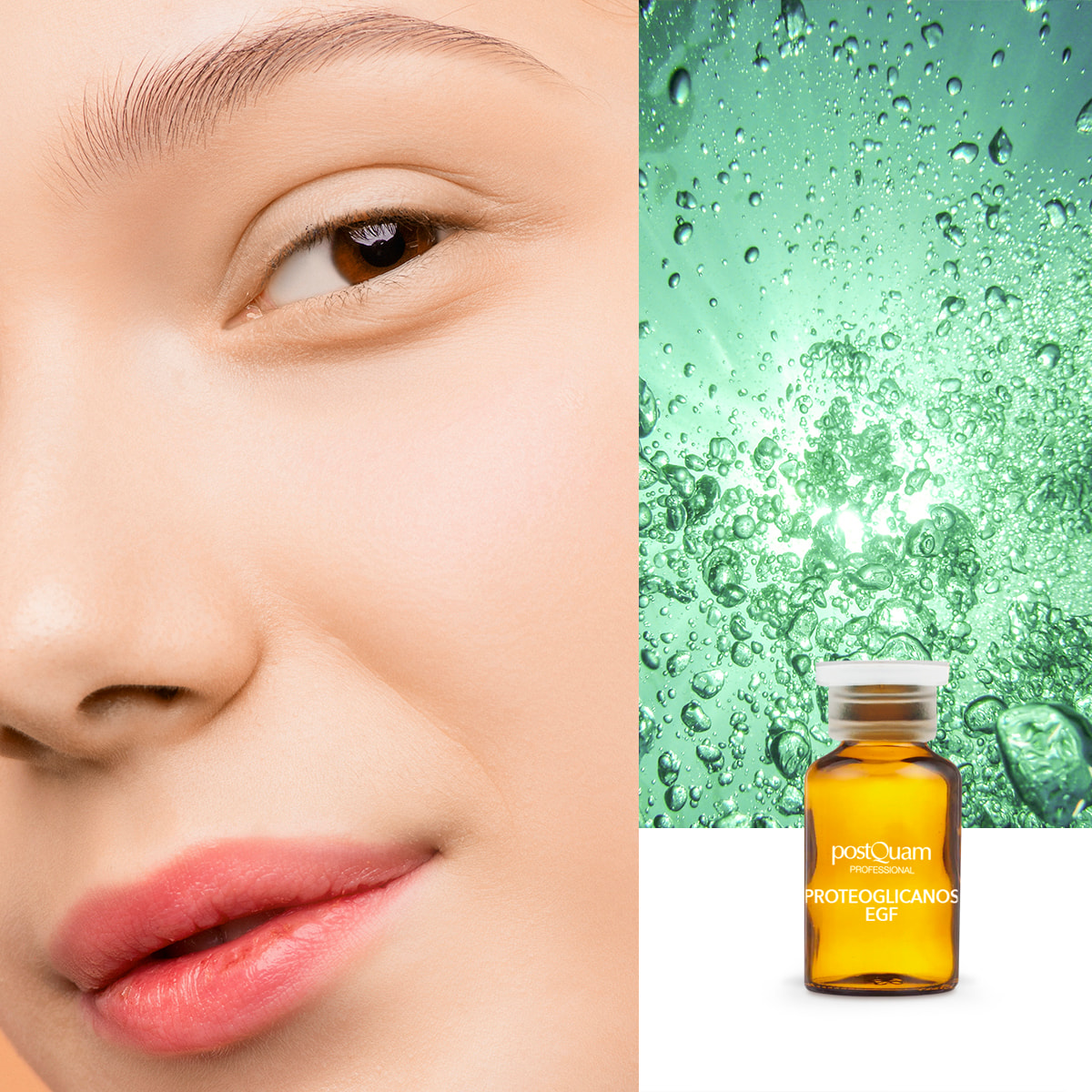 Protéoglycanes egf postquam 10x2ml