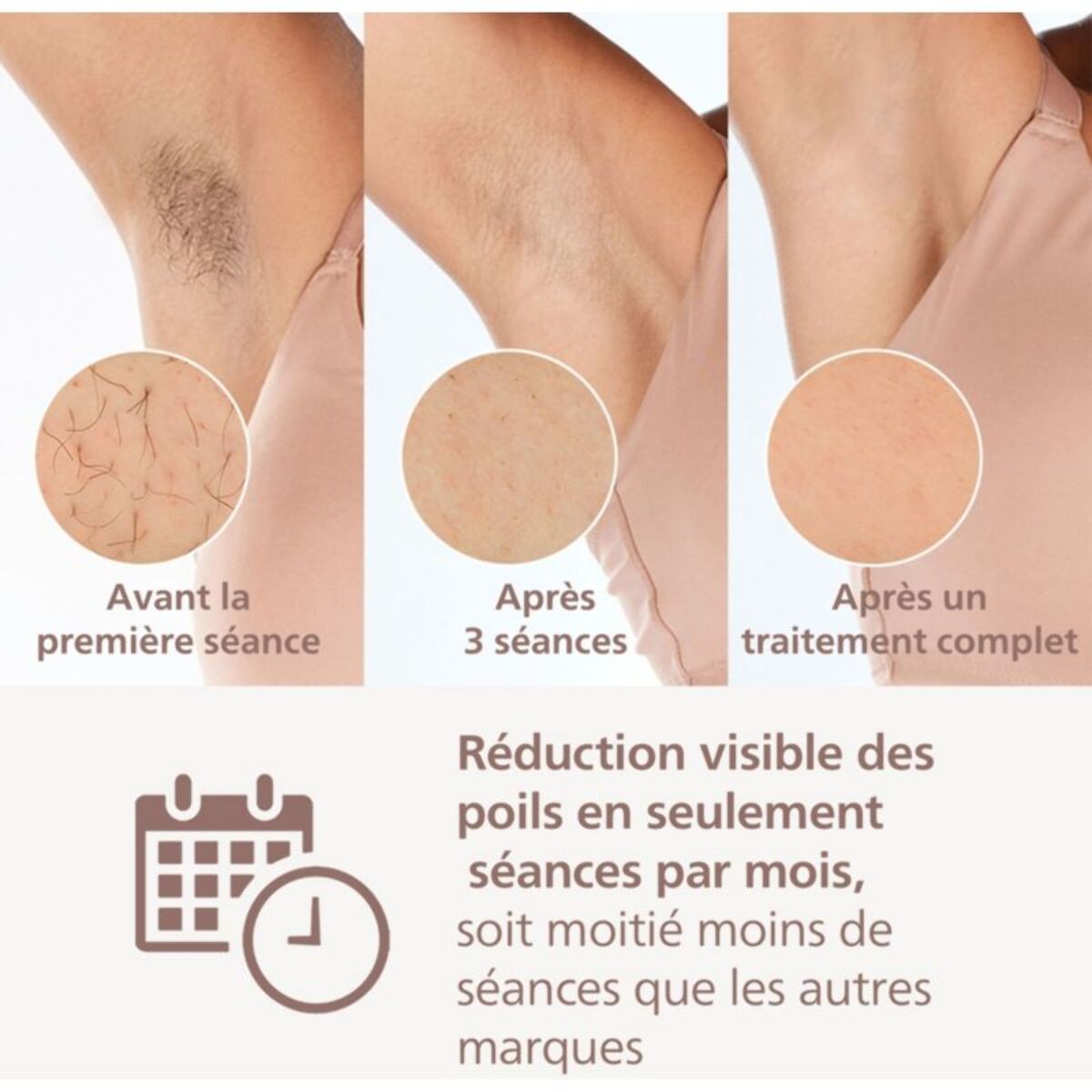 Epilateur lumière pulsée PHILIPS Lumea série 9900 BRI951/01