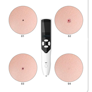 Penna multifunzionale all'ozono con 5 testine.