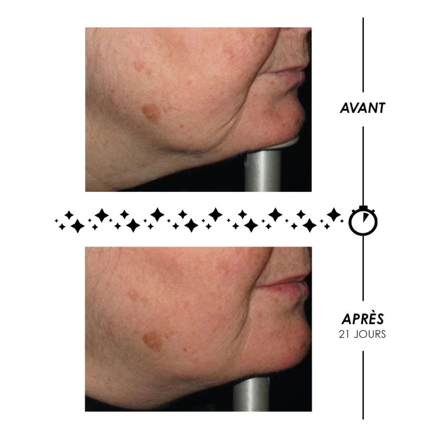 Étoile du Jour - Crème Riche Rose Suprême Volumatrice Anti-Âge